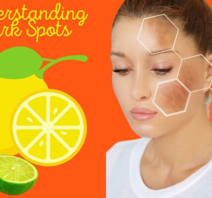 wellhealthorganic.com/easily-remove-dark-spots-lemon-juice