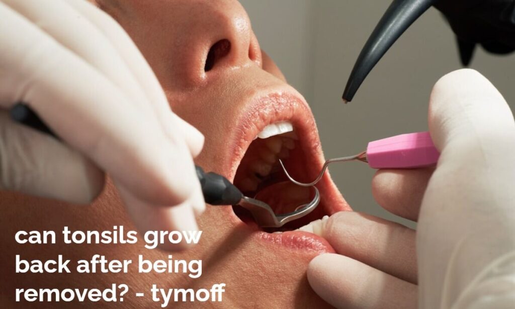 can tonsils grow back after being removed - tymoff